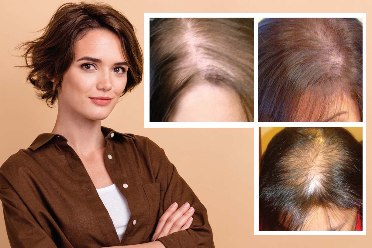 Stretchable Volumizer With Lace Front